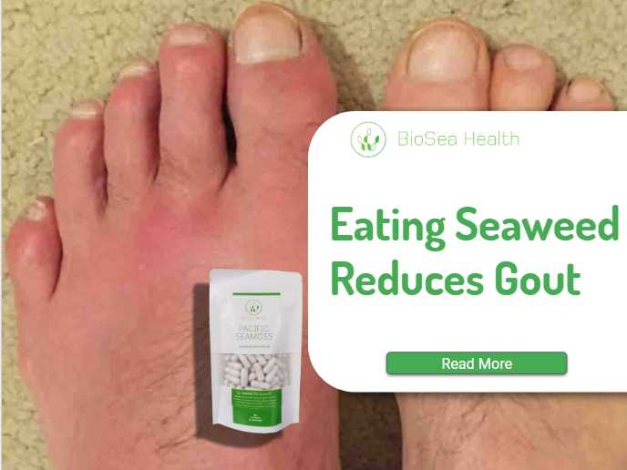 seaweed reduces gout or hyperuricemia with Pacific Seamoss