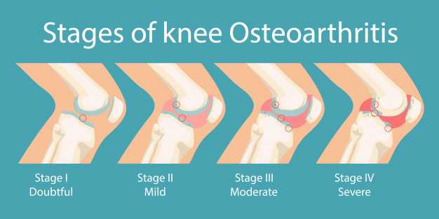 seaweed reduces arthritis in knees